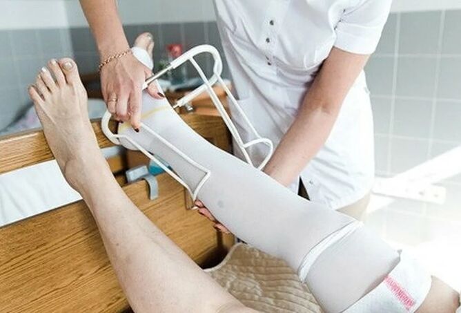 Período postoperatorio de la cirugía en las venas de las piernas
