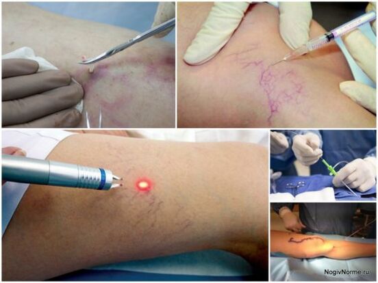 Tipos de tratamiento