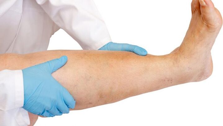 cómo identificar la enfermedad